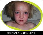 
          
: measles-300-w.jpg
: 332
: 23.8 
ID: 12587
    