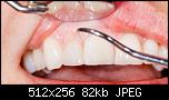 
          
: demineralizaciya-emali-zubov-u-vzroslyh-i-detey.jpg
: 124
: 82.0 
ID: 17428
    
