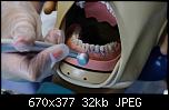 
          
: procedura-separacii-zubov-foto.jpg
: 62
: 31.6 
ID: 17489
    