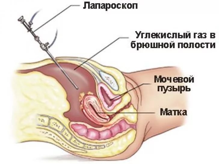 
      : i-13 (1).jpg
: 341

: 49.1 
    