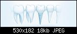 olivadent implant