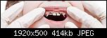 
          
: lechenie_periodontita.jpg
: 86
: 413.8 
ID: 17390
    