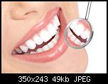white teeth products at wholesale prices