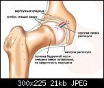 tazobedrenny sustav 300x225