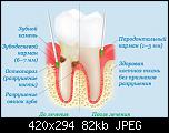 parodentium 85