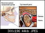 Temporomandibular joint