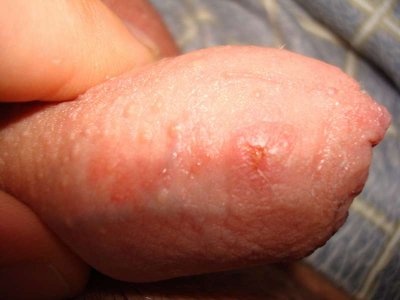 DSC09536_thumb.jpg