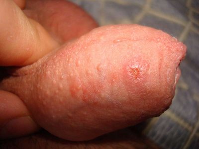 DSC09537_thumb.jpg