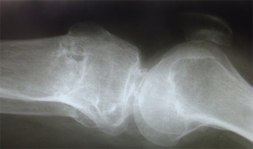 noga3.jpg