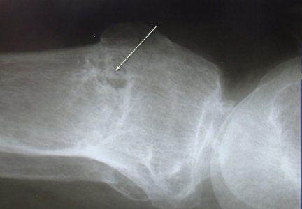 noga4.jpg