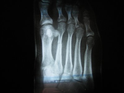 IMG_0008.JPG IMG_0008.JPG
