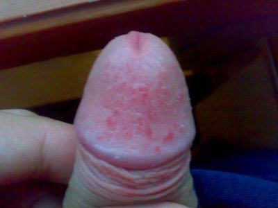 25052010365.jpg