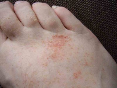 SSA46291.jpg