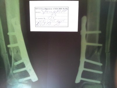 20130805_122457.jpg
