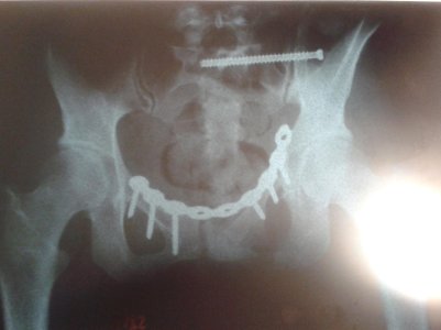 20161103_084446.jpg
