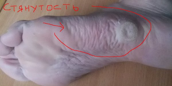 20170417_164511.jpg