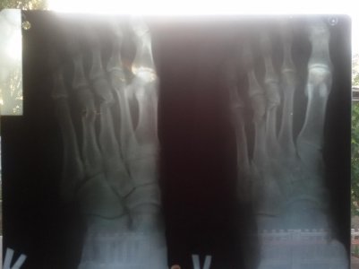 20170716_195855.jpg