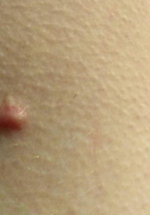IMG_20171116_210652.jpg