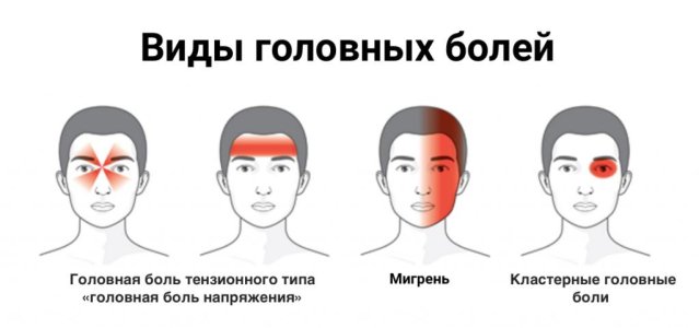 Головные боли.jpg